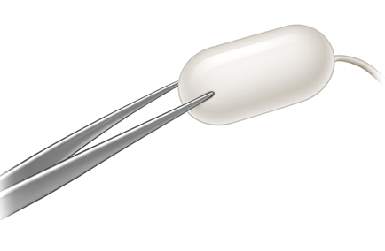 Swallowable Gastric Balloon
